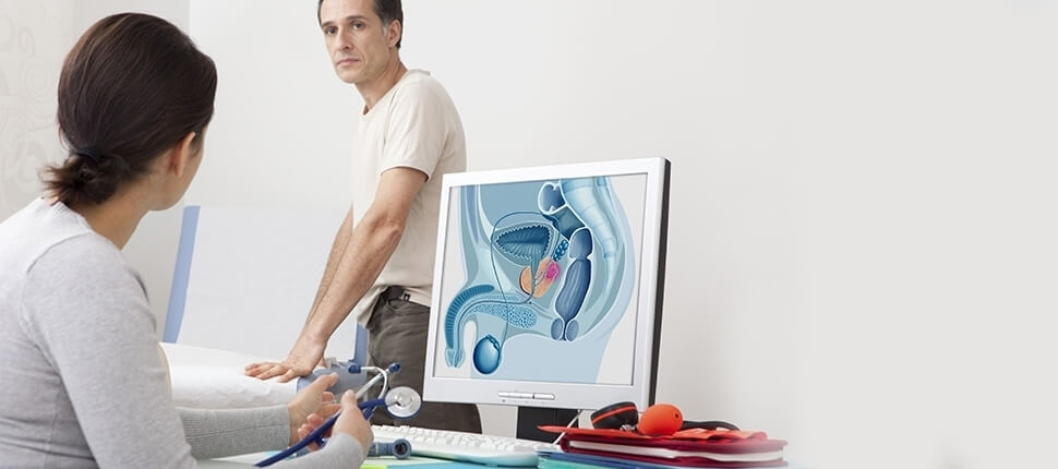 ADENOMA PROSTATICO 5 1 prostata