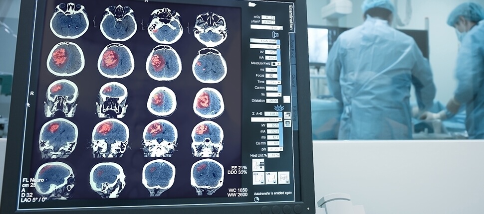 PATOLOGIE CEREBROVASCOLARI 4 13 CEREBROVASCOLARI