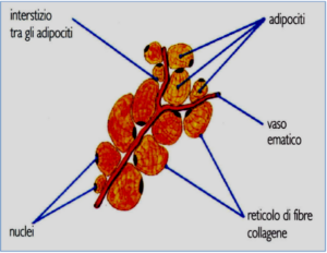 CELLULITE E ADIPOSITA' LOCALIZZATA 2 cellulite stadio - normale